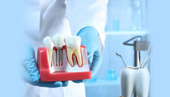 10 Long-Term Oral Health Benefits of Choosing Dental Implants