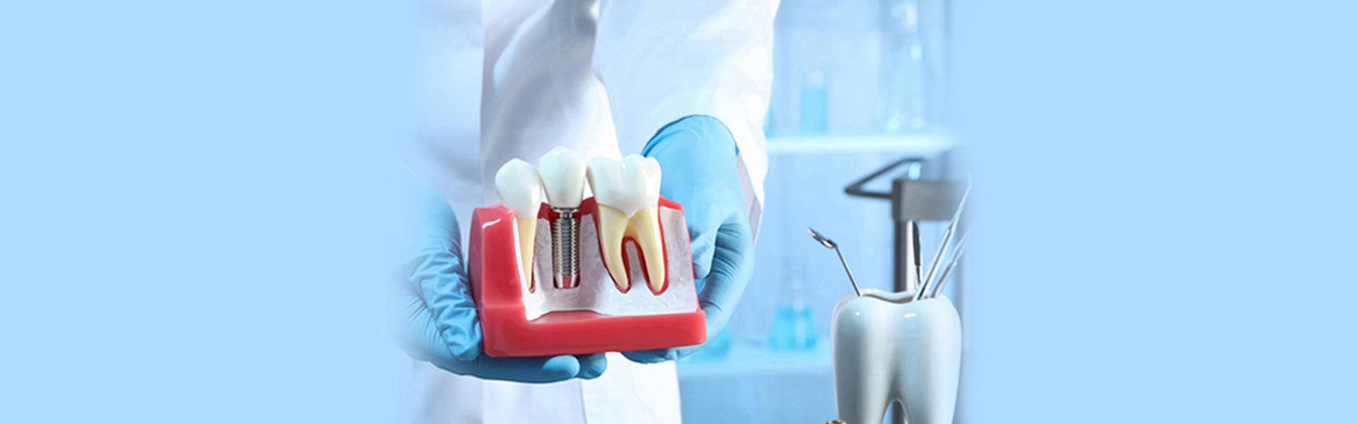 10 Long-Term Oral Health Benefits of Choosing Dental Implants