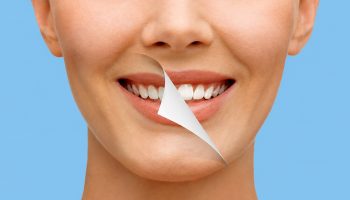 What to Expect During the Teeth Whitening Treatment?