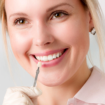 Dental Veneers