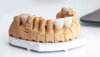 Can You Get Veneers on Just One Tooth?